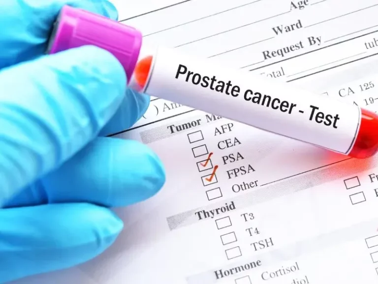 Quando o PSA é preocupante: cuidados e como agir?