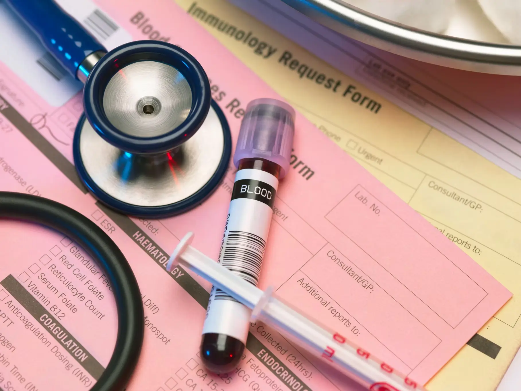 Exame PSA - Saiba o que é e a sua importância