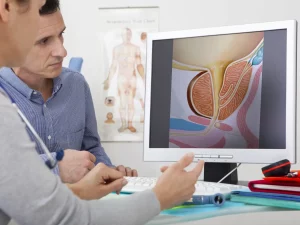 10 razões para procurar um urologista