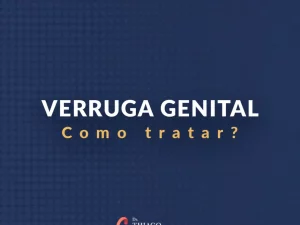 Verruga genital - Como tratar?