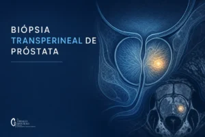 Ilustração médica sobre Biópsia Transperineal da Próstata vs Transretal: Qual a Mais Segura? — Dr. Thiago Mourão, urologista em São Paulo