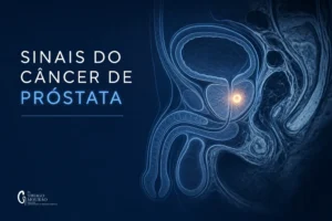 Ilustração médica sobre Sinais de Câncer de Próstata no Novembro Azul: 10 Que Todo Homem Deve Conhecer — Dr. Thiago Mourão, urologista em São Paulo